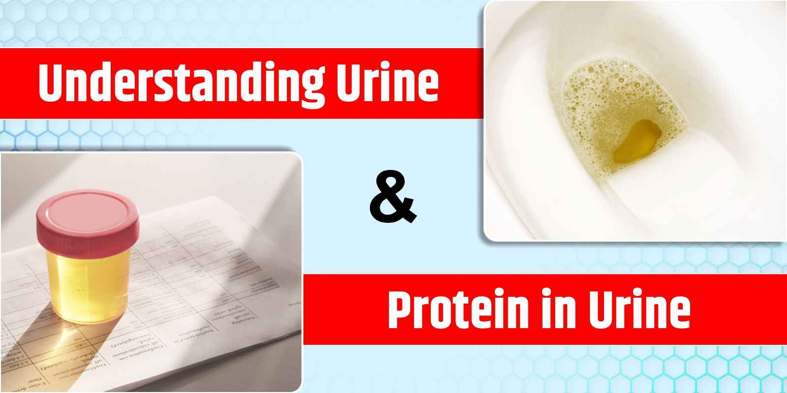 Understanding Urine and Protein in Urine